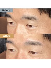 眉毛ハウス 吉祥寺店(眉毛HOUSE)/お客様の施術例(吉祥寺/東京)