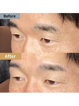 眉毛ハウス 吉祥寺店(眉毛HOUSE)/お客様の施術例(吉祥寺/東京)