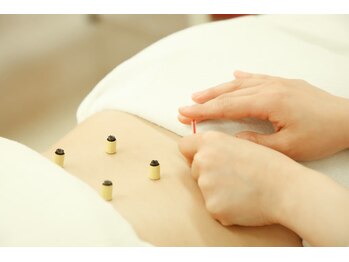 ほねつぎ須屋鍼灸接骨院/しつこくて頑固なコリに鍼灸が◎