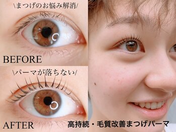 アンルル(EYE+anruru)