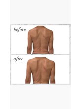 シャルマン(Charmant)/背中のハミ肉軽減上半身筋膜