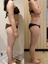 アイワン トータルビューティ(Aione totalbeauty)/Before/After