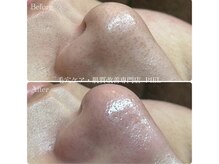 ピエル 北千住店(PIEL)/2回目ご来店のお客様