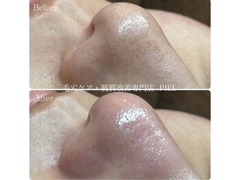 ピエル 北千住店(PIEL)/2回目ご来店のお客様