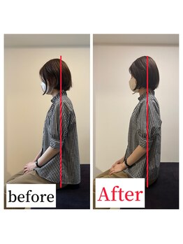 整体院ストック(Stock)/猫背・巻き肩before after #整体
