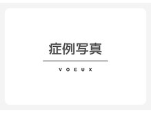 ボウ 名古屋店(VOEUX)/VOEUXの症例写真