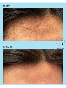 ココ 2号店(CoCo)/