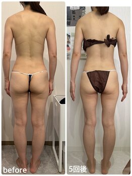 ラピスラズリ/ポールシェリー5回[ザスパイン]