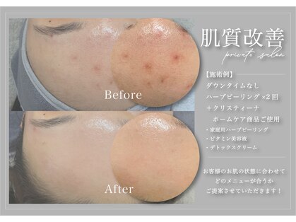 エルエーズ(Elleaise)の写真