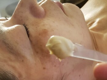 イクヨノ ビューティーサロン(194's beauty salon)の写真/【1回で変化を実感、3回で動き出す】敏感肌にこそ試してほしい"育てるハーブピーリング"で本気の肌質改善。