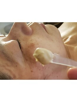 お肌をきれいにしたい