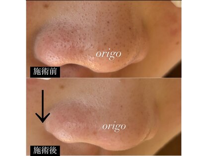 オリーゴ アイラッシュ(origo.eyelash_A/N)の写真
