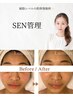 デリケートケア【SEN管理★】敏感肌/痒み/赤みに◎ ¥17,000