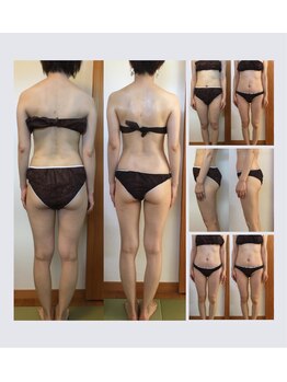 ニコ(nico)/施術8回目