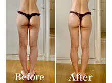 マルデビジュ 西宮(Mar de Bijou)/運動しても痩せなかった脚も！