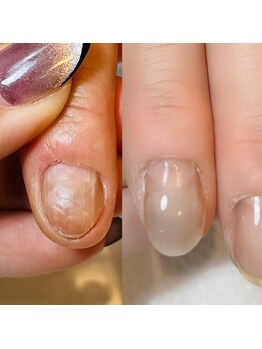 ロータス(LOTUS)/爪トラブルご相談ください！