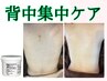 【背中美人】つるぴか背中！ハーブピーリング/オプション付　¥15400→¥11000
