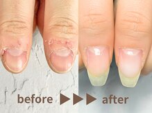 ナチュリア(Natulea)/カラーしながらもここまで美爪