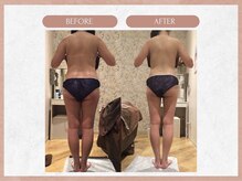 ソウイボディ 川崎本店(Sou-i body)/お客様before→after#自分磨き