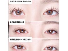 ラッシュバー ビューティーサロン(LASHBAR beautysalon)の雰囲気（最先端技術＆ヘンシー(逆さまつげ、瞼のたるみが気になる方に)）