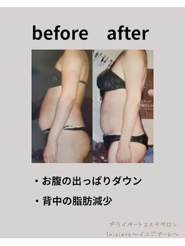 イニジアーレ(Iniziare)/ビフォーアフター