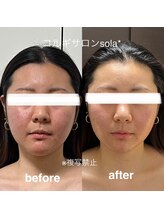 ソラ(sola*)/痩せた？と言わせる自信がある