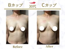 Ms.やまとなでしこ/ビフォーアフター