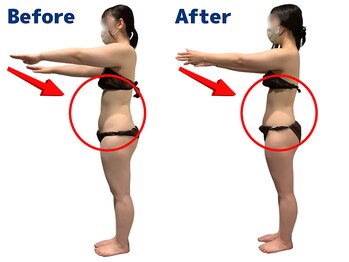 ワクワクボディクリニック 二俣川店(WAKUWAKU BODY CLINIC)/ガチガチの下腹部が柔らかく♪