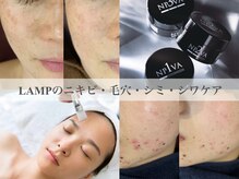 ランプ(LAMP)の雰囲気（【肌トラブル改善】大好評！マイクロニードルピーリング取扱店☆）