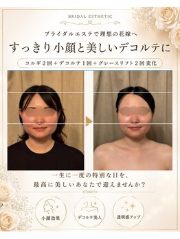 アイミーボーテ(Aime beaute)/ブライダルエステ