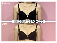 ククナ 新潟本店(KUKUNA)/＊バストアップケア＊