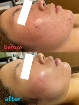 フェルヴィータ(Felvita)/