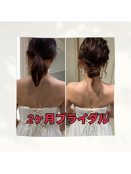 サンテボーテ(Sante Beaute)/ブライダルエステ