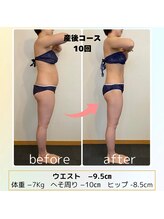 整体ルーム ココロ 金沢(Cocoro)/before after