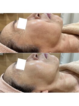 リッツ 所沢店/【Before/After】目元