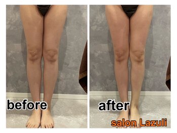 サロン ラズリ 久留米店(SALON Lazuli)/【1回施術】筋膜リリース痩身