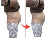 リセル(Recell)/お腹★脂肪分解