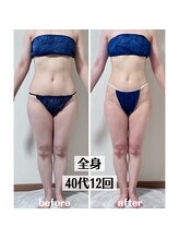 グラチア(Gratiae)/40代/脂肪撃退3ヶ月プログラム