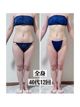 グラチア(Gratiae)/40代/脂肪撃退3ヶ月プログラム
