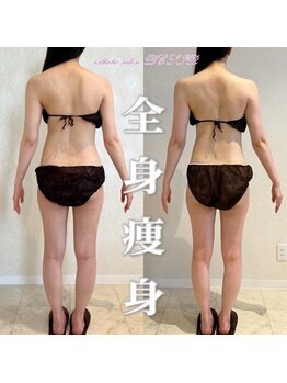 デジール(DESIR)/【オーダーメイド痩身コース】