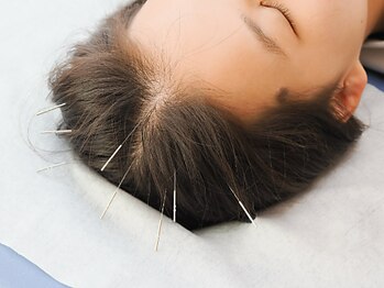 すがはら鍼灸院の写真/女性鍼灸師による丁寧な施術で安心感◎痛みの少ないソフトな施術で首・肩・腰のお悩みを改善へと導きます！