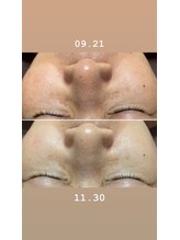 コルッソ(CoLusson.)/くすみ無しのお肌へ