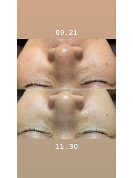 コルッソ(CoLusson.)/くすみ無しのお肌へ