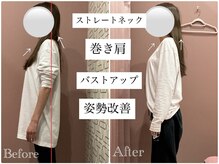 ユルル 刈谷店(Yururu)/変化(骨盤整体＆猫背整体)