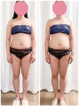ミロク(369)/脂肪冷却痩身　20カップ終了