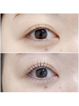 フー(woo)/ラッシュリフト