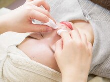 フレーズ(fraise)/毛穴エクストラクション