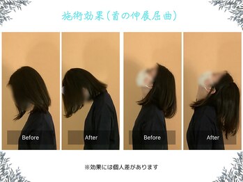 ボディ リセット アンド デザイン(Body Reset & Design)/【施術例】ビフォーアフター