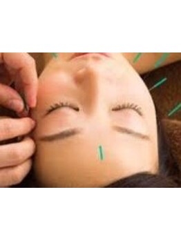 鍼灸施術を受けたい