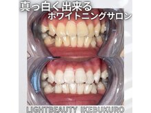 ライトビューティー 池袋店(LightBeauty)/症例写真